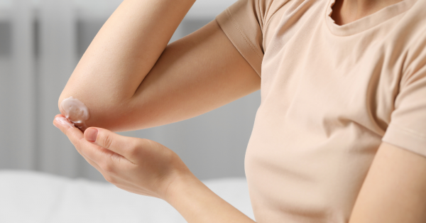 Ohio severe Eczema, Rosacea, Sunburn, & Anti-Aging Prescription Rx Creams Lotion compounding pharmacy